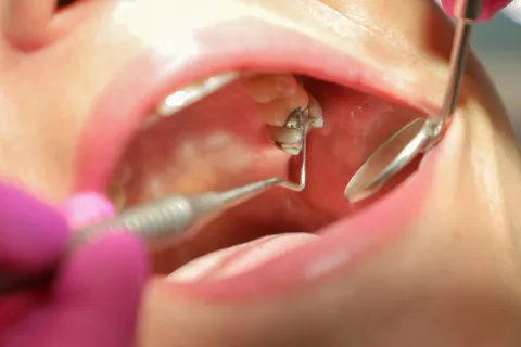 Dnevi odprtih vrat so lahko priložnost, da pravočasno poskrbimo za svoje ustno zdravje. / Foto: Tina Dokl, arhiv Gorenjskega glasa