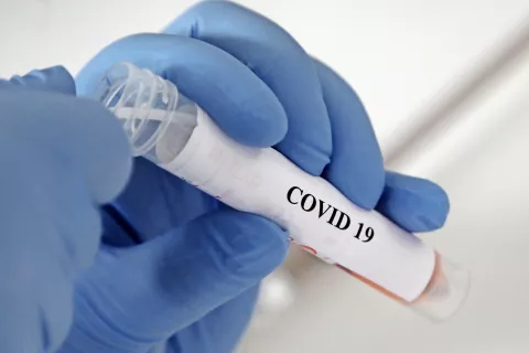 Dve okužbi z novim koronavirusom so v sredo potrdili na območju domžalske občine, eno pa v občini Kranj. / Foto: Gorazd Kavčič / Foto: 